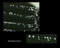 bordetella pertussis